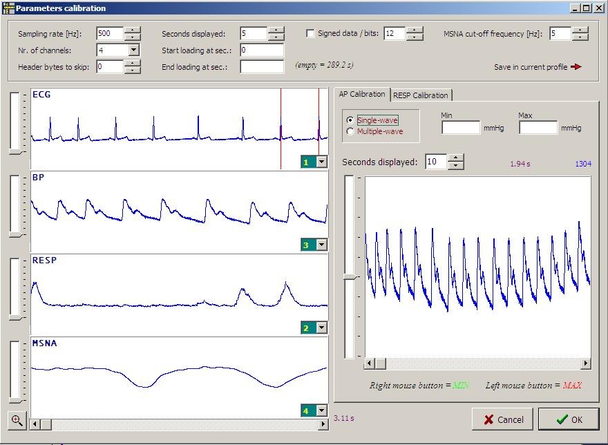 Software Tools for Continuous ecg Recordings (Holter)