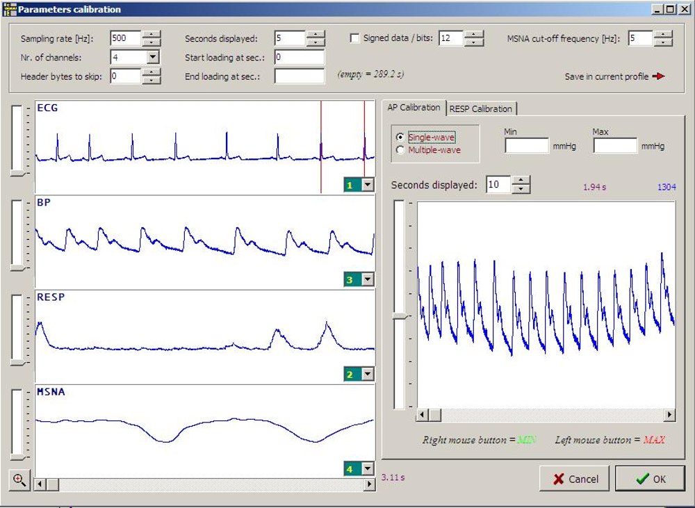 Continuous ECG Recordings